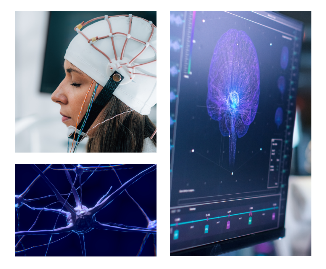Person undergoing brain mapping and qEEG analysis to measure reduced anxiety, improved focus, and emotional regulation