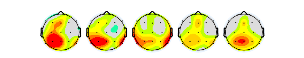 Baseline brain map and cognitive assessment establishing initial neural patterns
