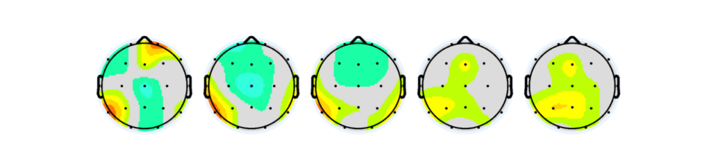 Follow-up brain map and cognitive assessment showing changes after training