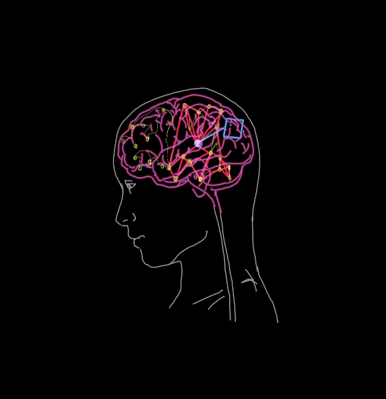 brain awareness is non-diagnostic and for pattern recognition
